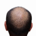 43890499_s-1-150x150 湯シャンは頭皮環境の改善に効果あり！正しいやり方と5つのコツ